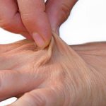 با این اشتباه تغذیه‌ای پوستتان را پیر می‌کنید