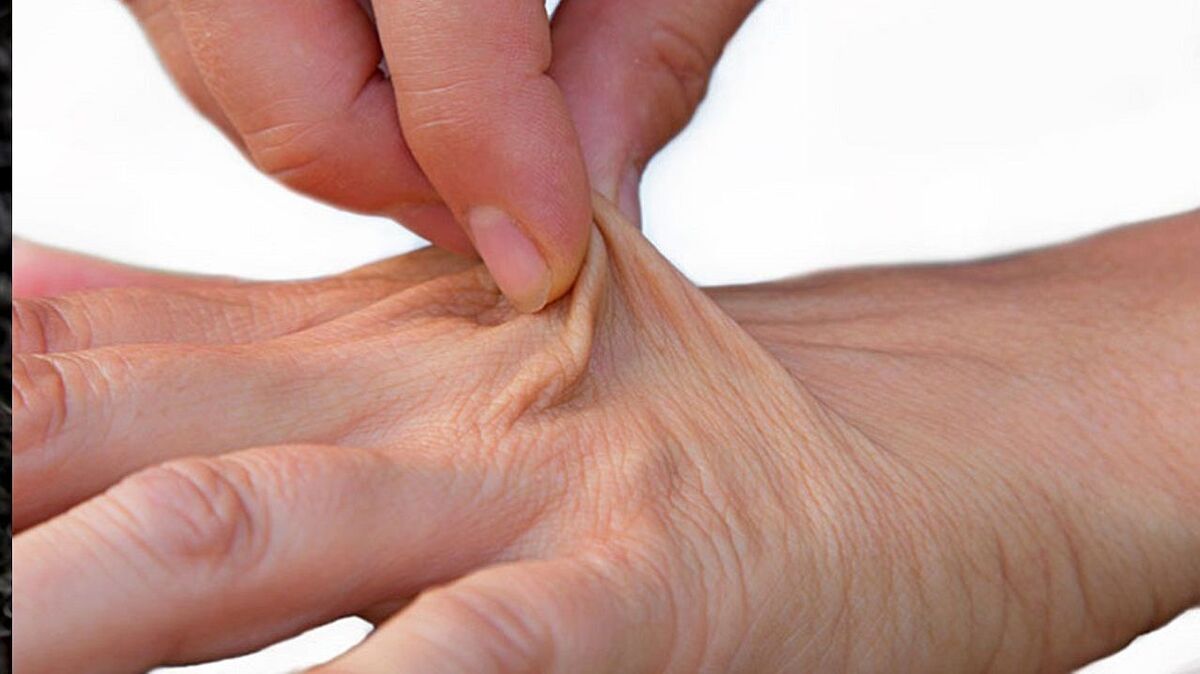 با این اشتباه تغذیه‌ای پوستتان را پیر می‌کنید