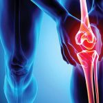 مصرف این نوشیدنیِ محبوب سلامت استخوان‌ها را به خطر می اندازد