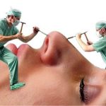 هیچ بینی‌‌ ایده‌آلی در جهان وجود ندارد